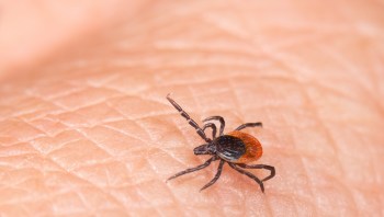 A close-up view of a tick on human skin showing its distinct black and orange body.