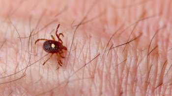 A close-up of a Lone Star tick with a dot on its surface crawling on human skin, showing fine hair and skin texture.