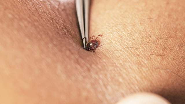 A close-up of a lone star tick being removed from the skin using a pair of tweezers.