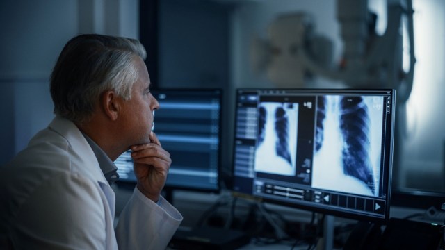 A doctor looking at chest x-rays in a lab.