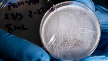 A close-up of a petri dish with white fungal growth, held in gloved hands against a dark background.