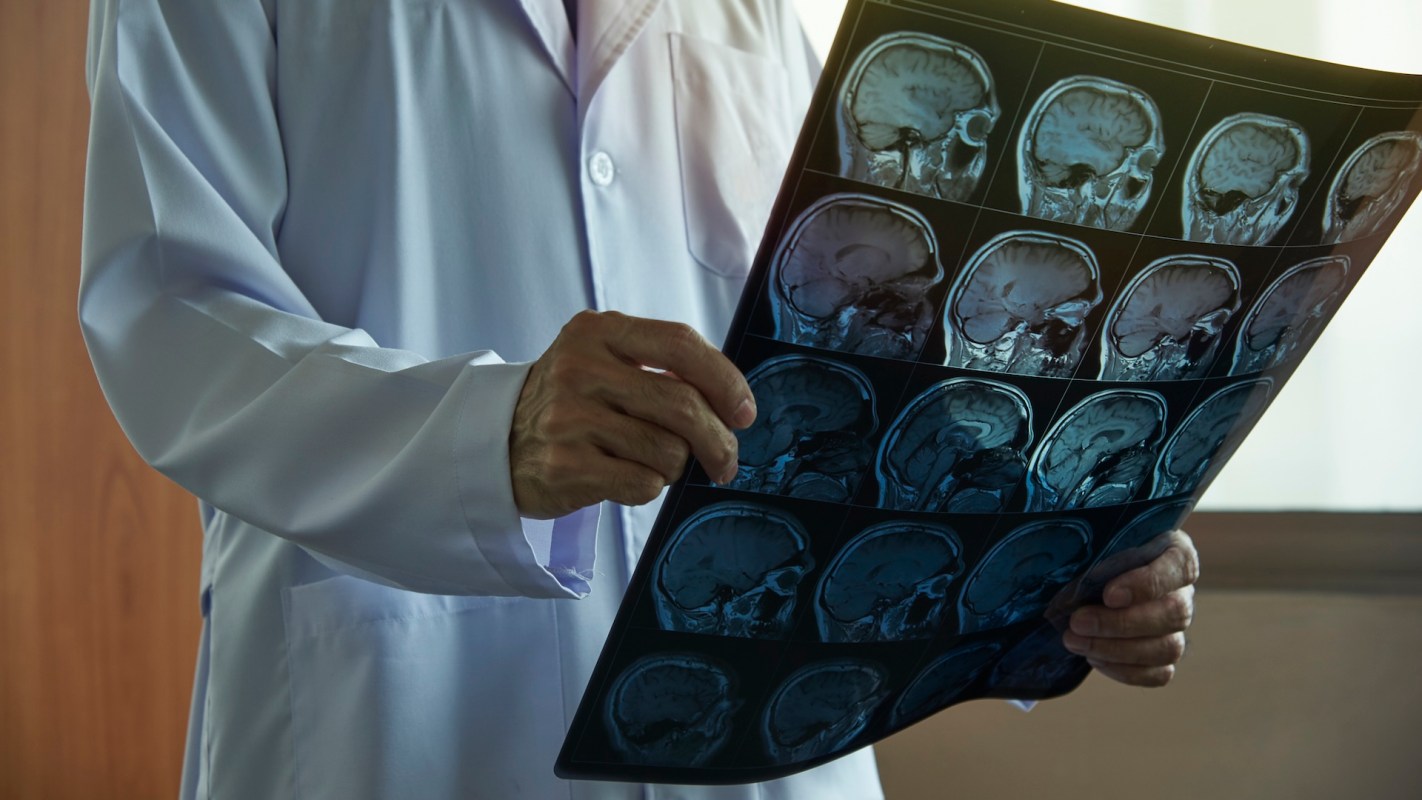 A doctor in a lab coat examines MRI brain scans while standing in a clinical setting.
