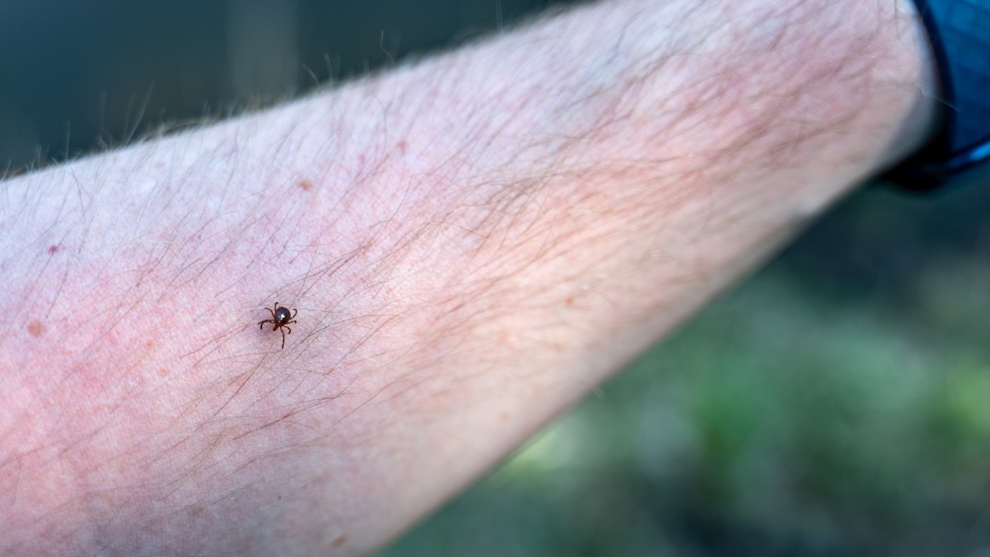 A close-up of a lone star tick on a person's forearm with visible hair and skin texture and grass in the background.