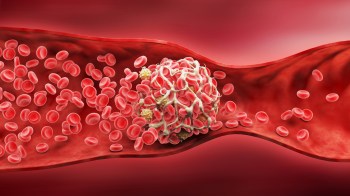 A close-up of red blood cells circulating in a blood vessel with a white blood cell visibly present.