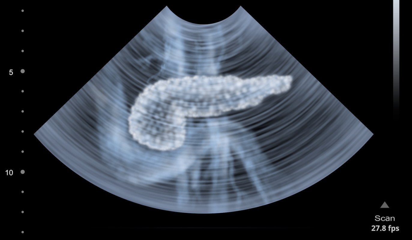 An ultrasound image showing a pancreas with a blurred background.