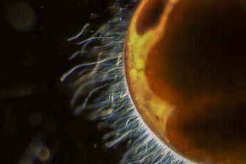 A close-up view of an object with fine, filamental structures emanating from its surface against a dark background.