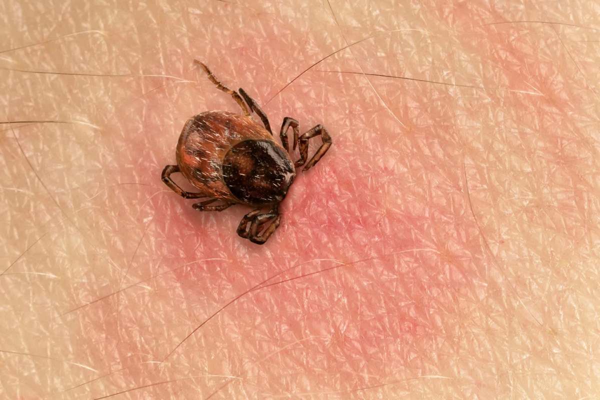 A close-up image of a tick sitting on human skin, showing fine details of the tick and skin texture.