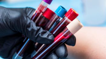 A gloved hand holds several blood collection tubes with colored caps against a blurred medical background.
