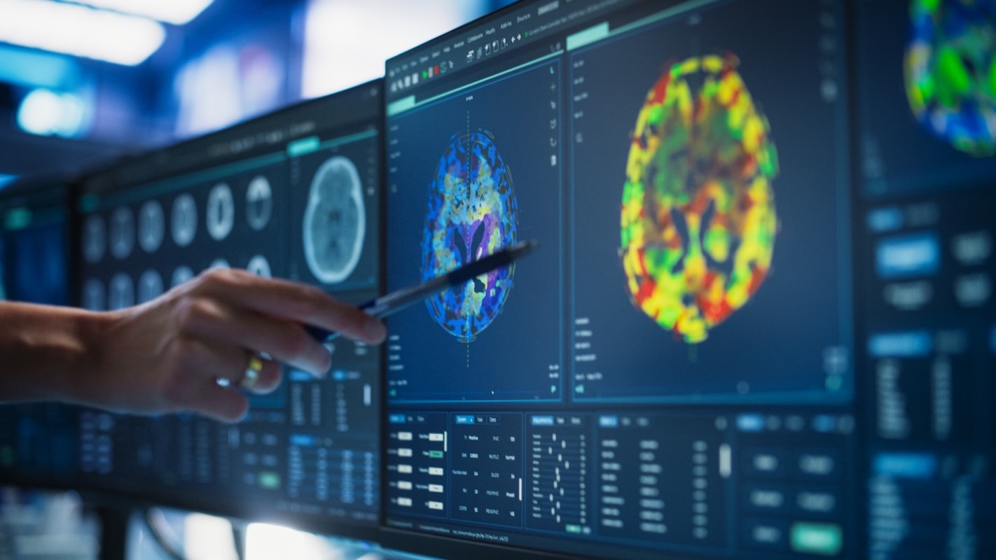 A hand uses a pen to point to colorful brain imaging results.