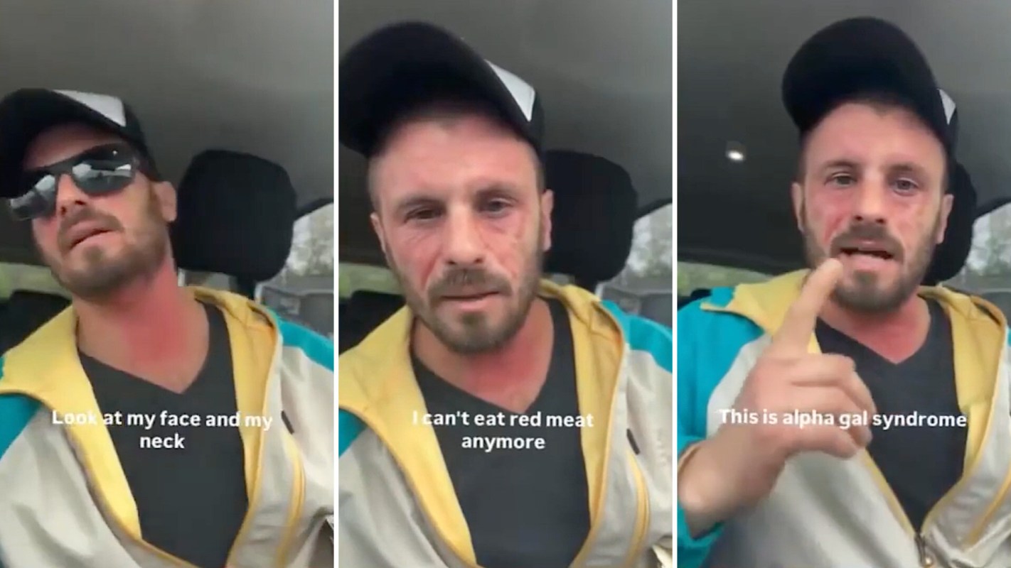 A man in a car discusses his symptoms related to alpha-gal syndrome, visibly distressed and gesturing with his hands.