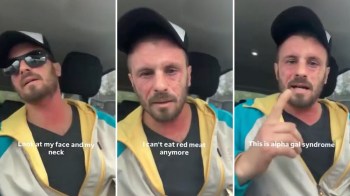 A man in a car discusses his symptoms related to alpha-gal syndrome, visibly distressed and gesturing with his hands.