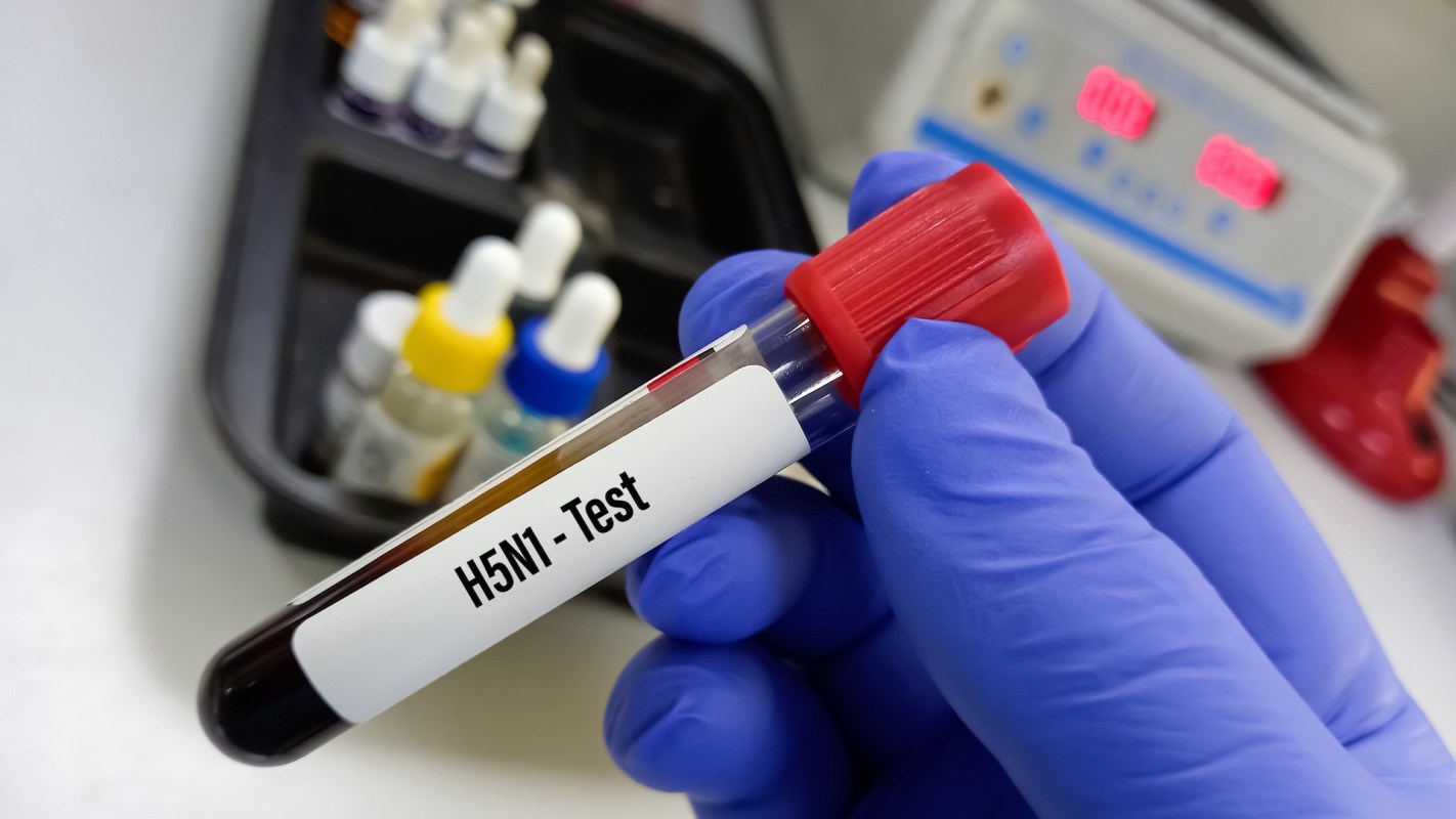 A gloved hand holds a test tube labeled "H5N1 - Test."