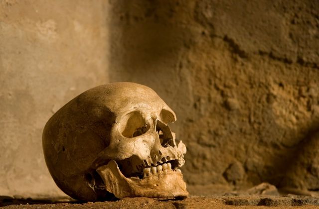 A human skull with teeth.
