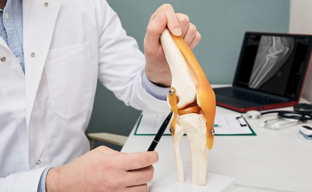 A medical professional holds up a knee joint model.