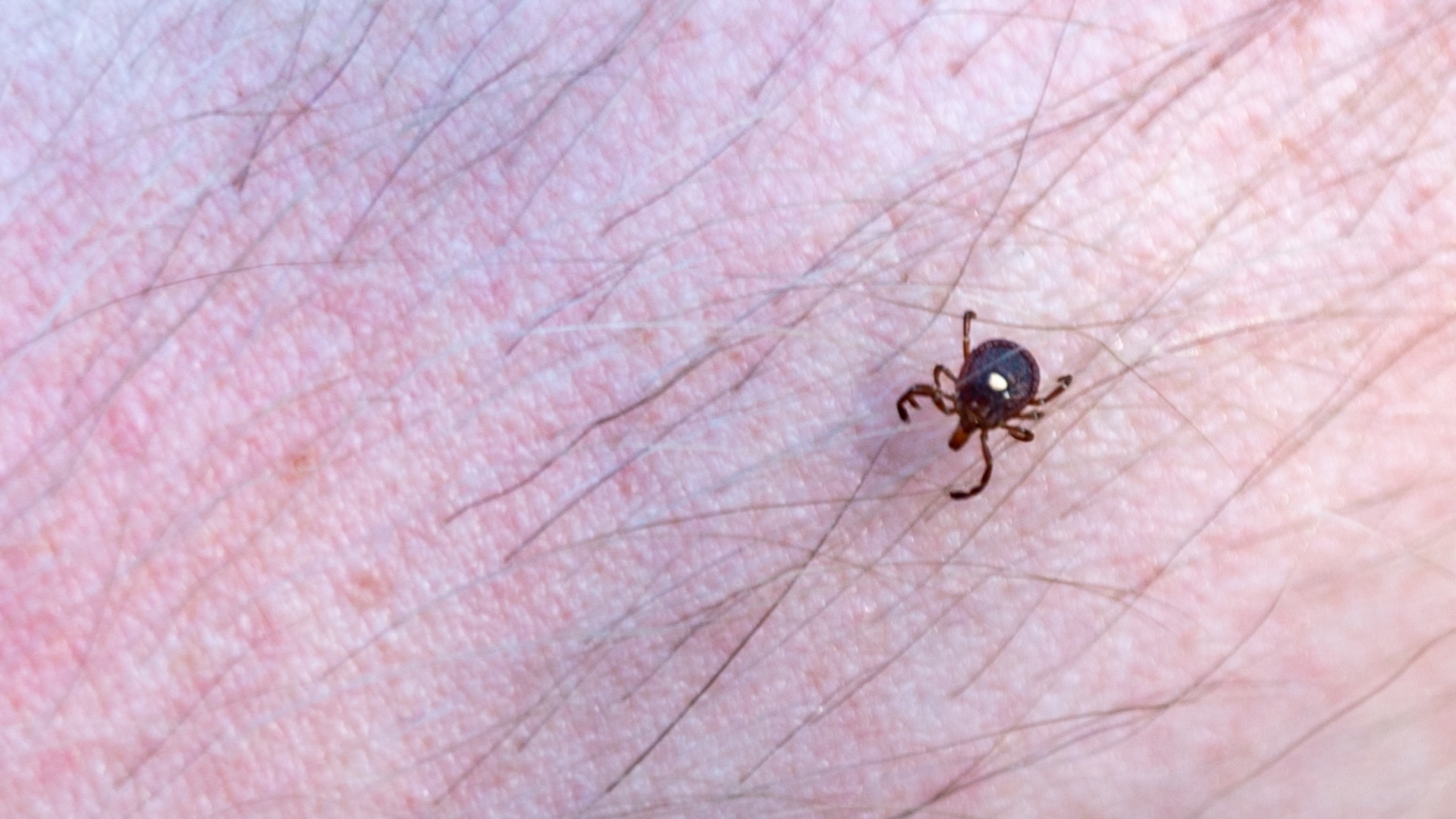Health officials warn Rhode Islanders to watch for fast-spreading tick tied to lifelong red meat allergy