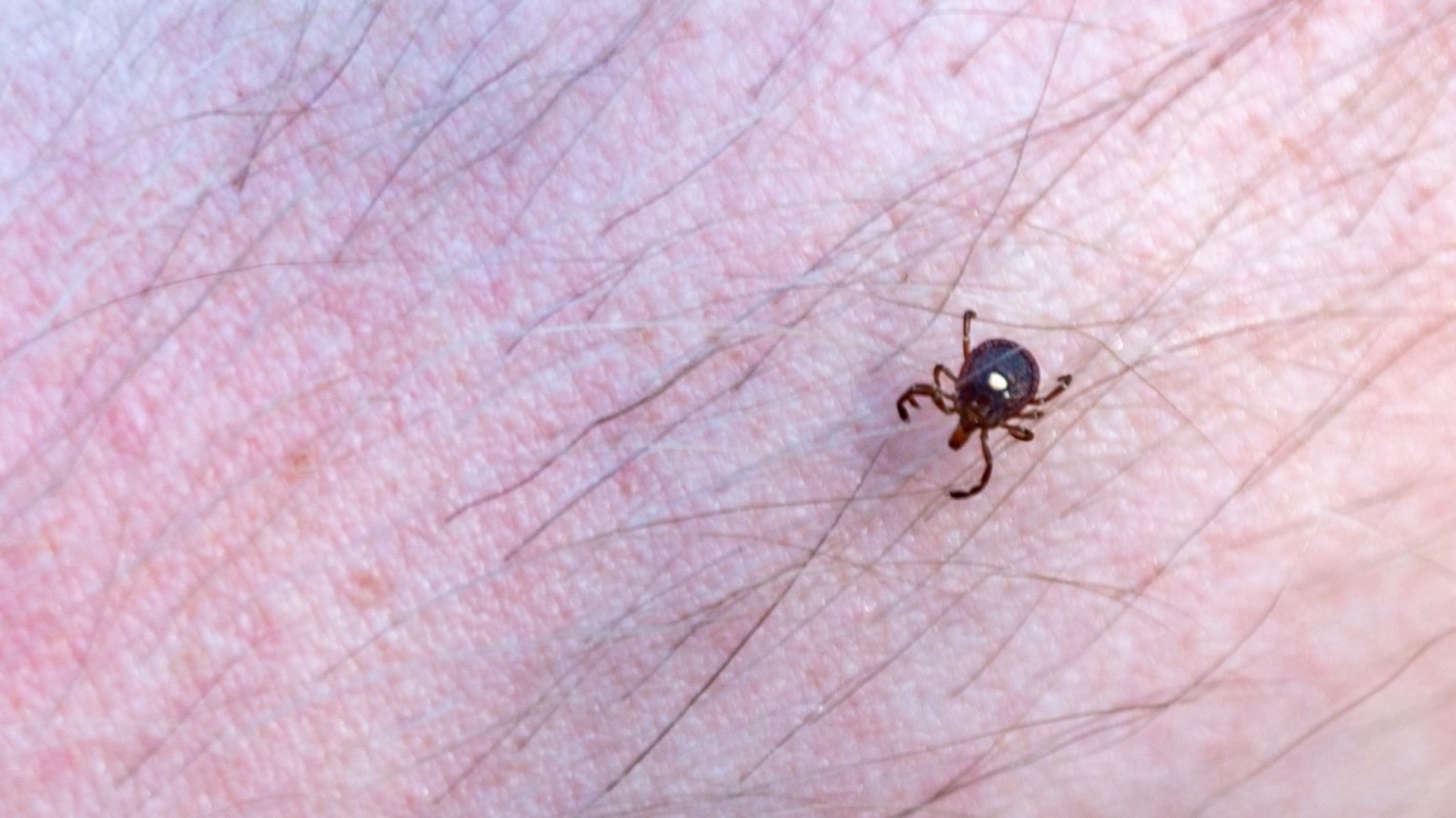 A close-up of a lone star tick crawling on human skin, highlighting fine hair and skin texture.
