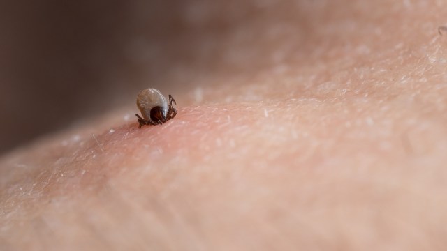 A tick attached to human skin.