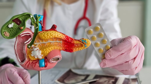 A medical professional holds a colorful anatomical model of the pancreas and a blister pack of yellow pills.