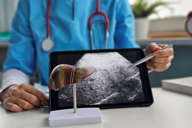 A medical professional points at an ultrasound image on a tablet next to a model of a liver.
