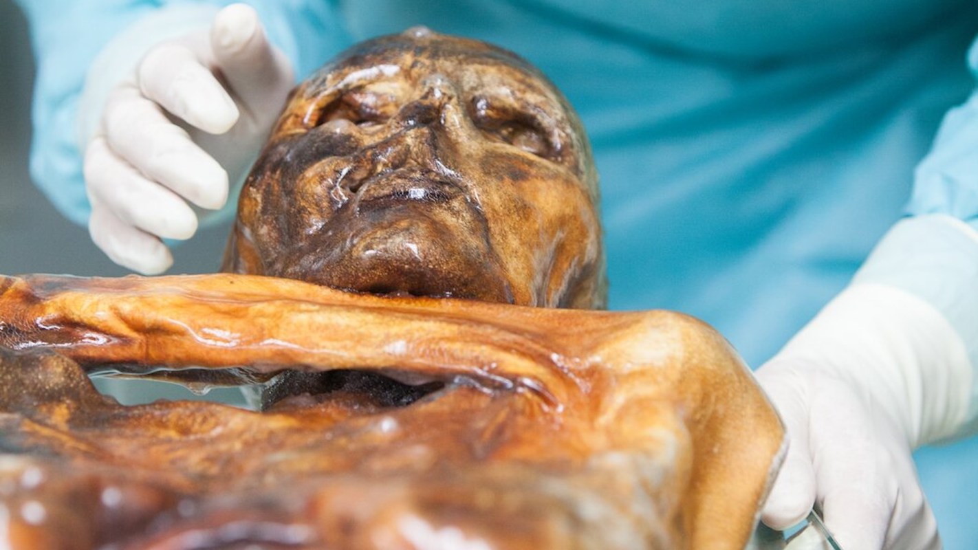 A close-up of a preserved human body in an examination setting, with a gloved hand adjusting it.