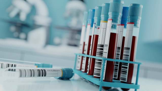 A tray with several blood sample tubes in a laboratory setting.