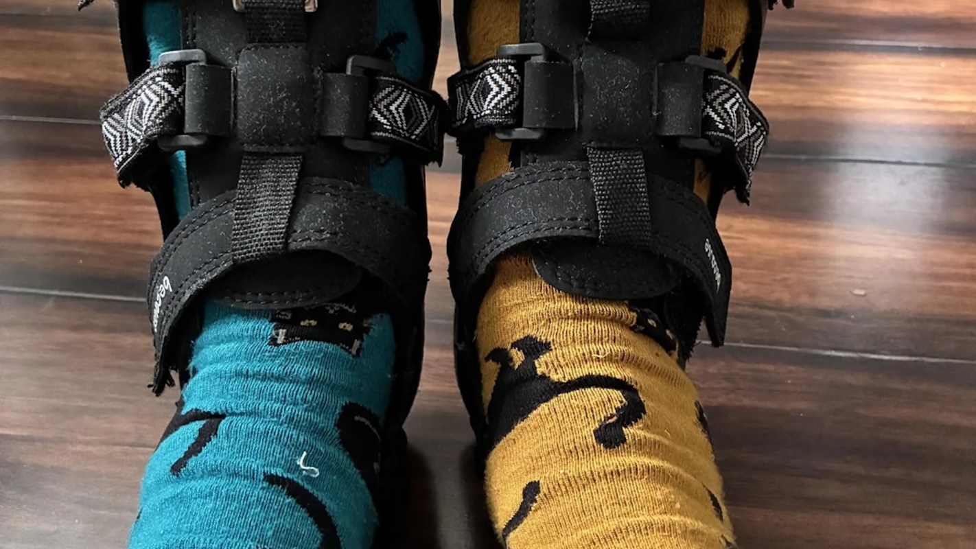 A close-up of two feet wearing mismatched socks, one turquoise with cats and the other yellow with a playful design.