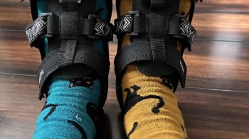 A close-up of two feet wearing mismatched socks, one turquoise with cats and the other yellow with a playful design.