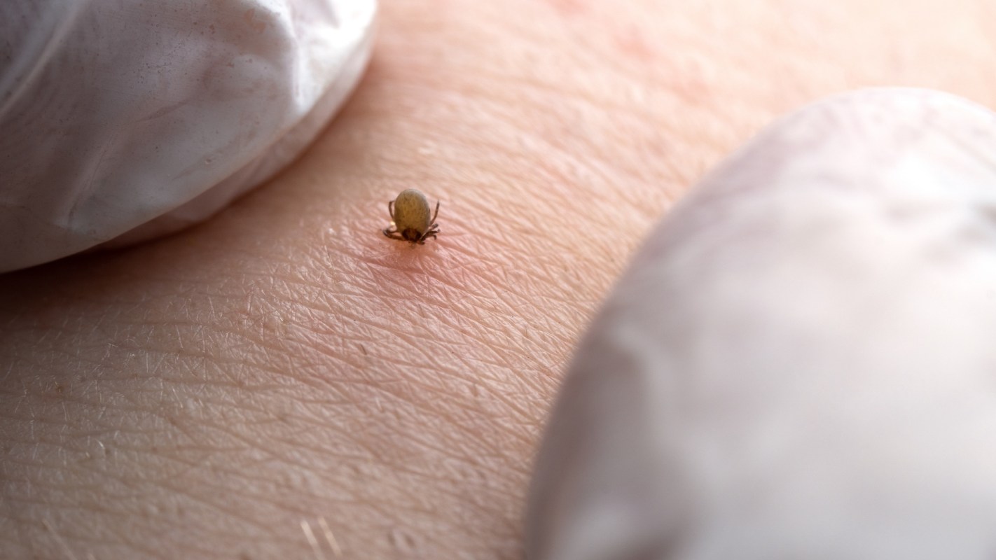A tick on human skin with gloved fingers partially visible.