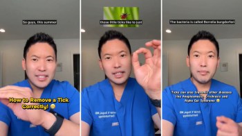 Dr. Daniel Sugai explains how to properly remove a tick, emphasizing related health concerns.