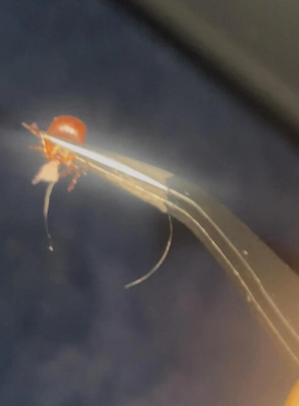 A bug held by tweezers. 