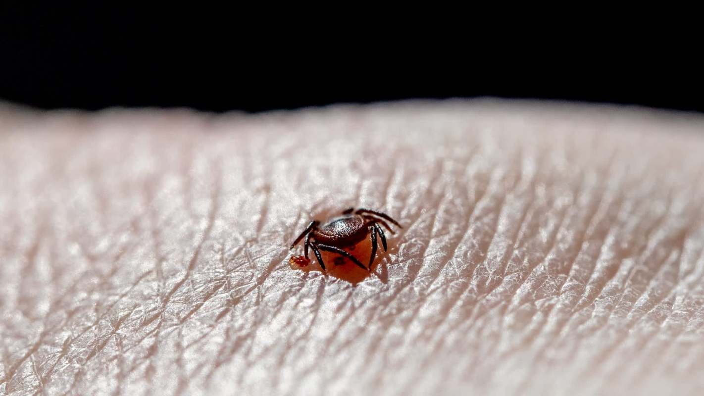 A close-up of a small tick embedded in the skin of a person.