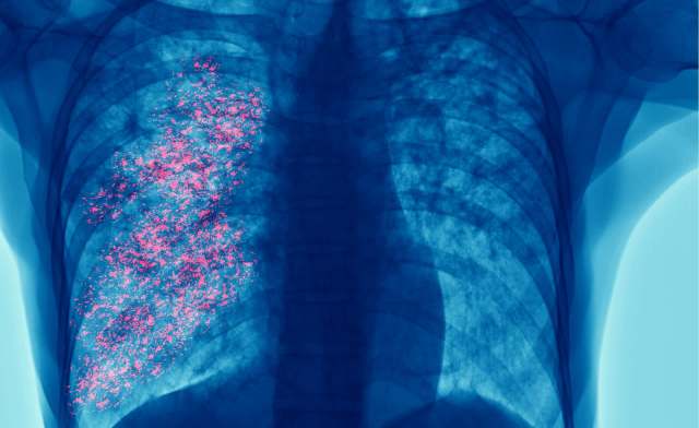 A digital X-ray of the chest and lungs.