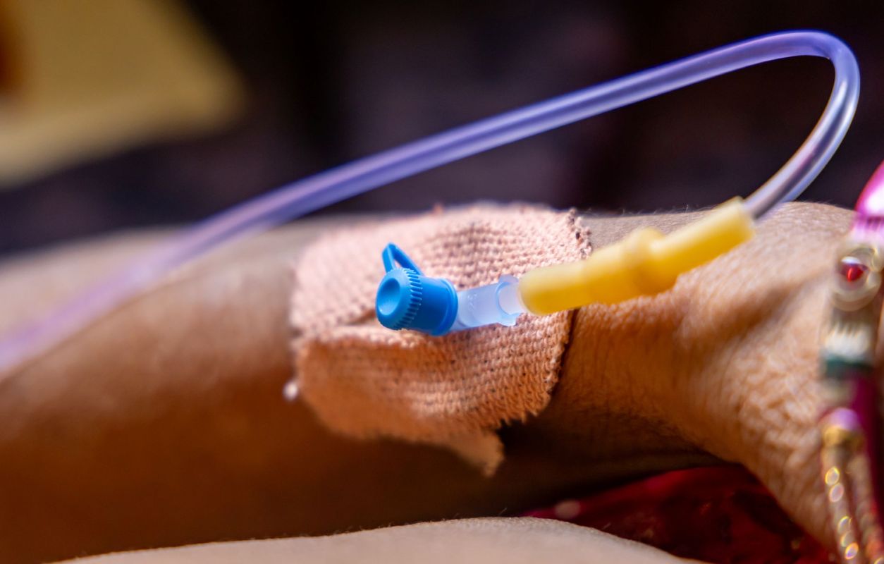 An IV cannula inserted into a patient's arm.