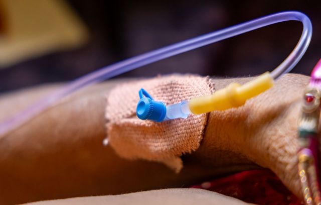 An IV cannula inserted into a patient's arm.