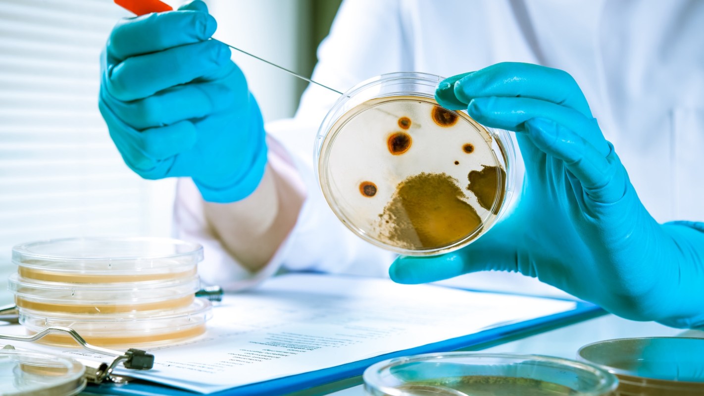 A gloved hand holds a petri dish with bacterial growth while an instrument is poised above it.