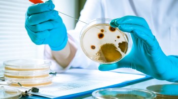 A gloved hand holds a petri dish with bacterial growth while an instrument is poised above it.