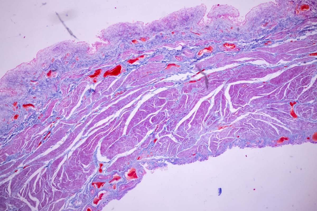 A microscopic view of tissue displaying various shades of purple and red with distinct cellular structures.