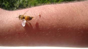 A bee rests on a human arm.