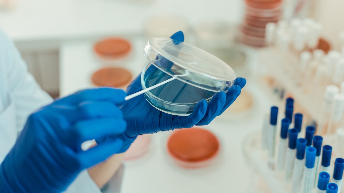 A person holds a petri dish with a swab in a laboratory setting.