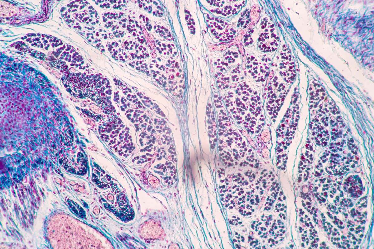 close up of human tissue under a microscope
