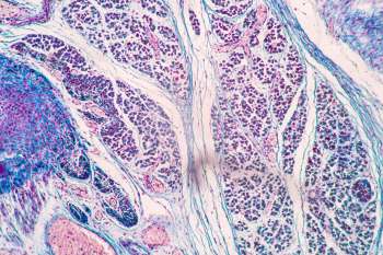 close up of human tissue under a microscope