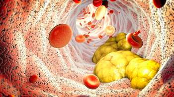 An illustration of blood cells and fat deposits inside a blood vessel.