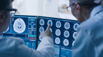 Two medical professionals examine brain scan images on a computer monitor.