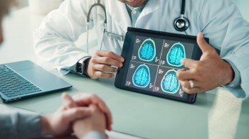 A doctor shows brain scans on a tablet to a patient during a consultation.