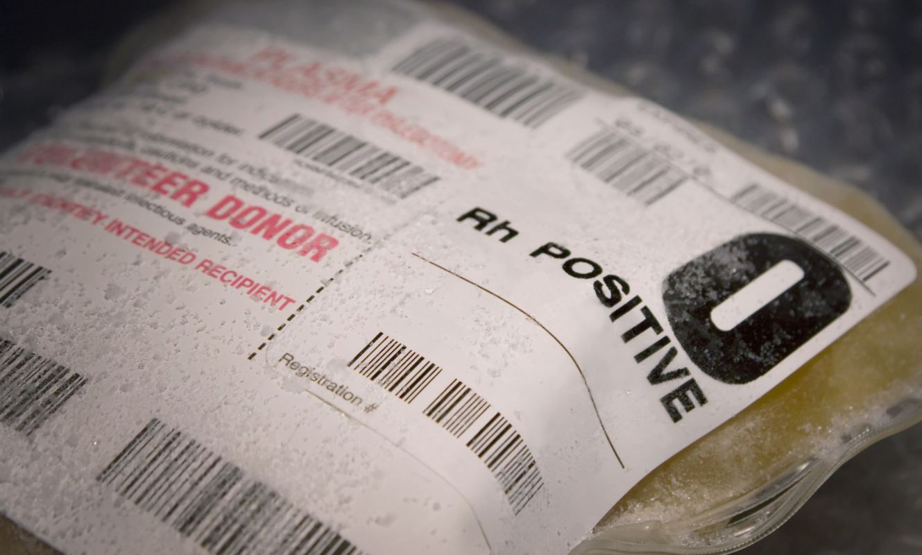 Frozen plasma.
