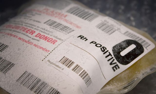 Frozen plasma.