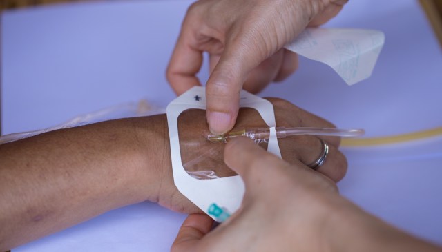 A person applies a dressing over an intravenous catheter on a hand.