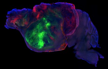 A colorful microscopic image of a brain section illuminated with various fluorescent dyes.