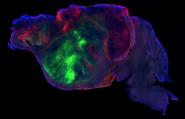 A colorful microscopic image of a brain section illuminated with various fluorescent dyes.