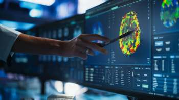 A hand points to a color-coded brain scan displayed on a computer screen.